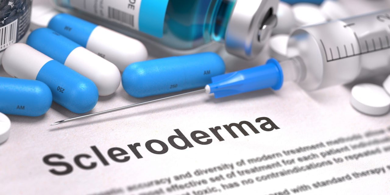 Scleroderma Symptoms-Finding the Right Therapy for You