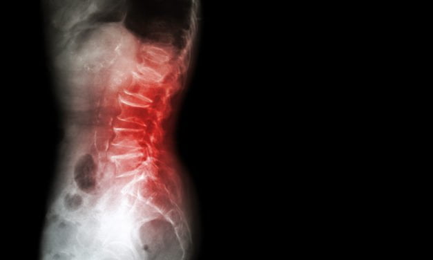 Drug-Free Pain Relief for Spinal Stenosis