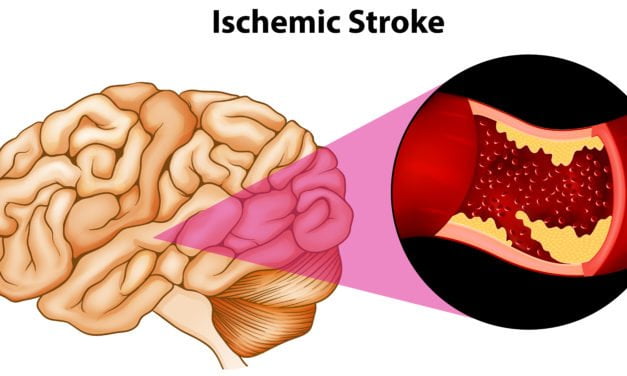 Treatment for Stroke-Could PEMF Therapy be an Accepted Therapy in Medicine?