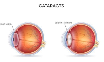 Can PEMF Therapy Heal Cataracts?