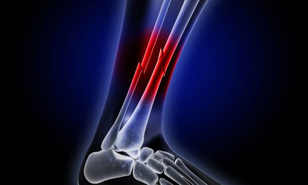 PEMF Therapy vs. Low-Intensity Pulsed Ultrasound-Which is Stronger?