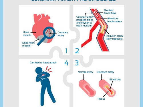 Why Coronary Artery Disease is Common and What to do About it