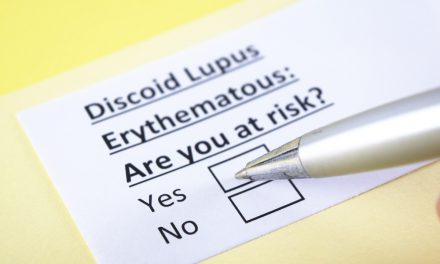 Using PEMF Therapy for Improve Symptoms of Cutaneous Lupus Erythematosus