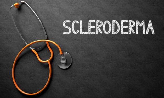 PEMF Therapy for Scleroderma and the Positive Outcome